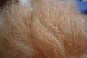 dry dull lifeless hair photo