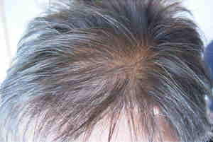 Hair Loss Treatments, Thinning Hair Treatments - Hairology.co.uk - 'The Root to Healthier Hair.'